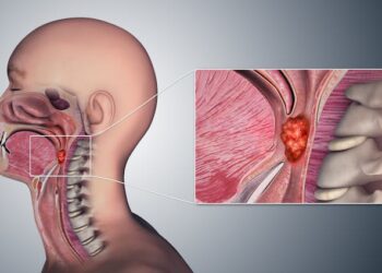 Oral Sex Overtakes Smoking and Alcohol as Leading Cause of Throat Cancer, Experts Warn