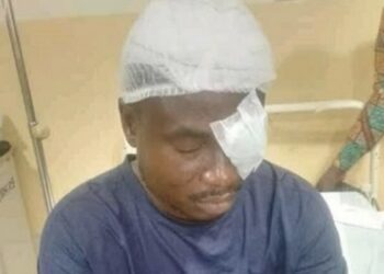 Asuoso SHS Teacher Regrets Choosing Teaching After Losing Left Eye in Student Attack