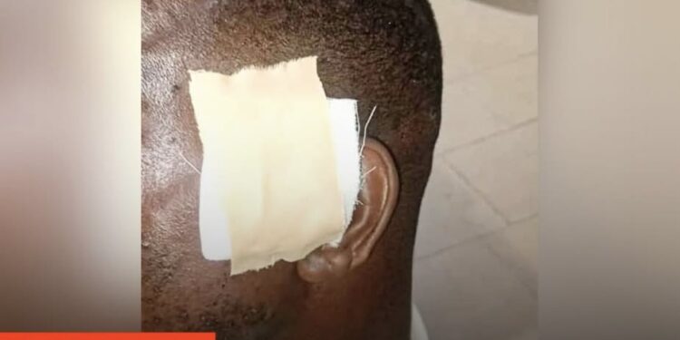 Police Officer Bites Off Colleague’s Ear at Winneba-Mankessim Barrier