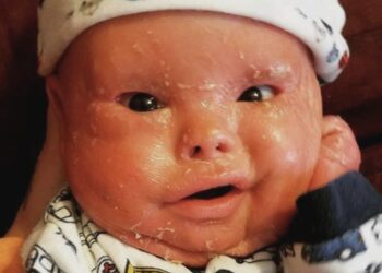 Parents Who Bleach Their Babies’ Skin Could Face Jail Time – CDD-Ghana Warns