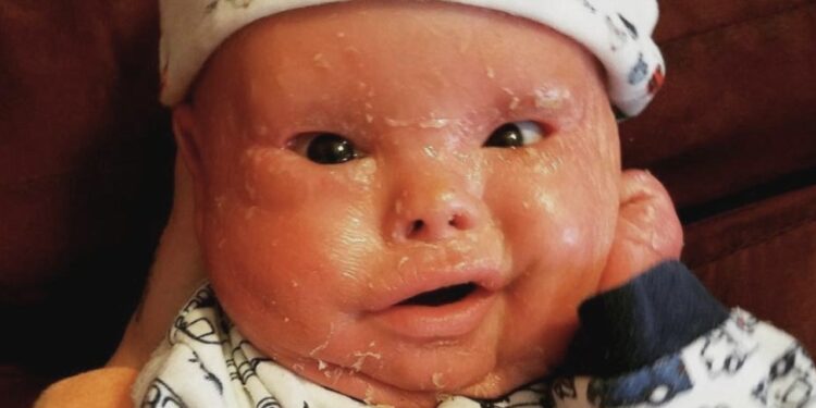 Parents Who Bleach Their Babies’ Skin Could Face Jail Time – CDD-Ghana Warns